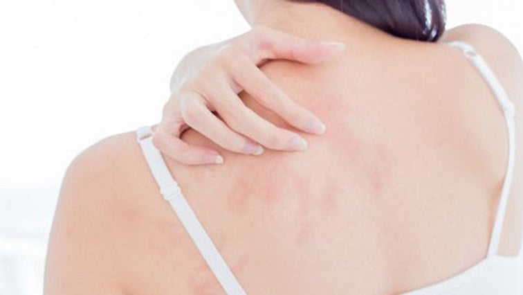 Cutimed® ACUTE 潤膚泡沫慕絲